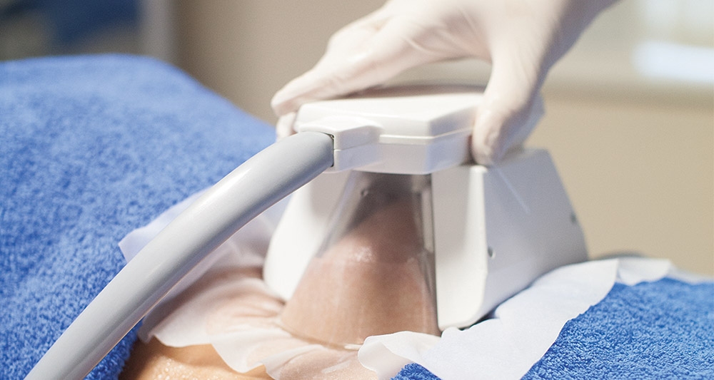 How Fat Freezing and HIFU Work Together? 2 Multiple Areas in One Session HIFU and Fat Freezing Amersham