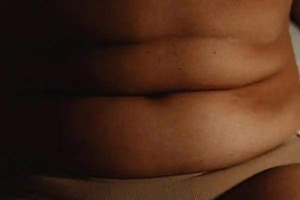 The Hidden Connection: How Stress Shapes Your Fitness and Body Composition 3 image of what stress can do on the stomach area and how Lipo 360 Amersham can help to change your body shape.