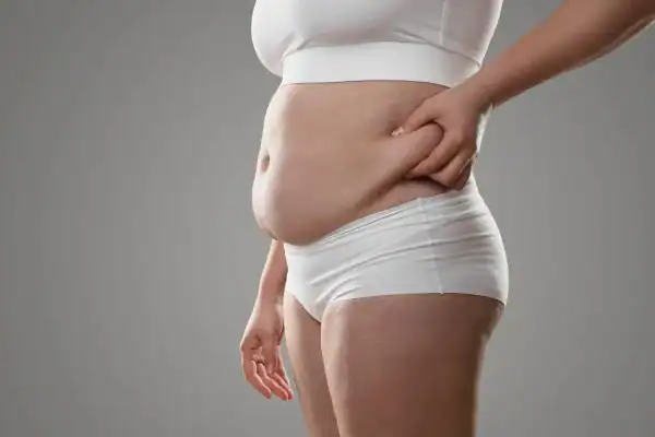 Image of stress belly Amersham How Lipo 360 can help manage your symptoms